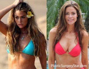 Denise Richards Before Breast Surgery